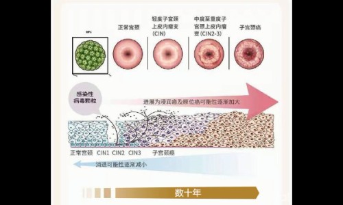 宫颈肥大用药能治好吗-宫颈肥大的用药网 | 宫颈肥大用药后会变小吗,宫颈肥大用药期间可以同房吗
